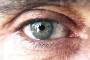 Read more about the article Diabetic Eye Conditions