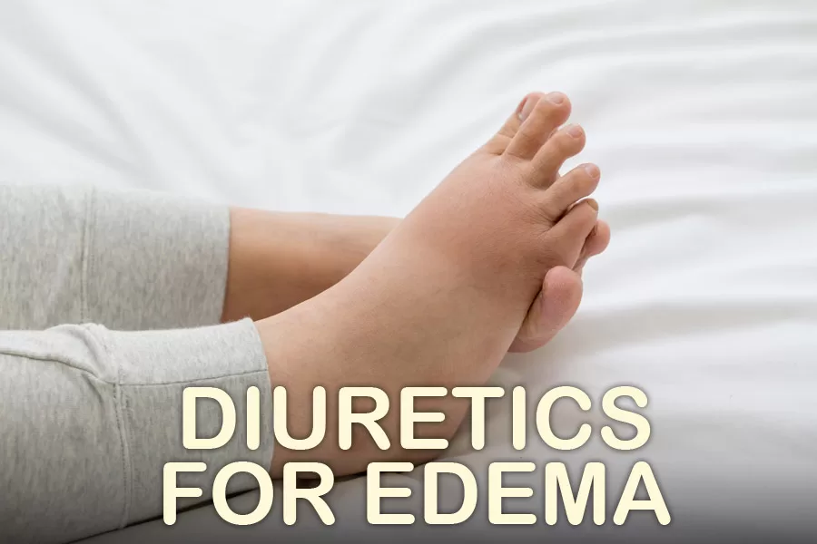 Read more about the article Benefits of Diuretics for Edema
